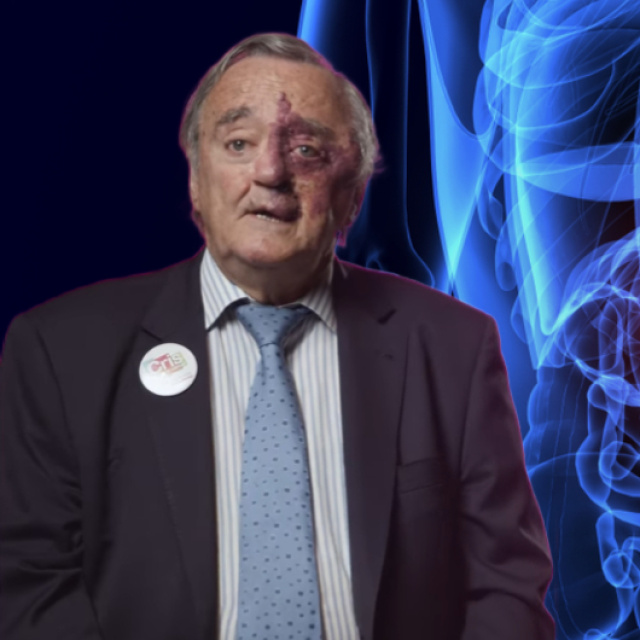 Pankreas kanserini tedavi eden araştırma umut oldu