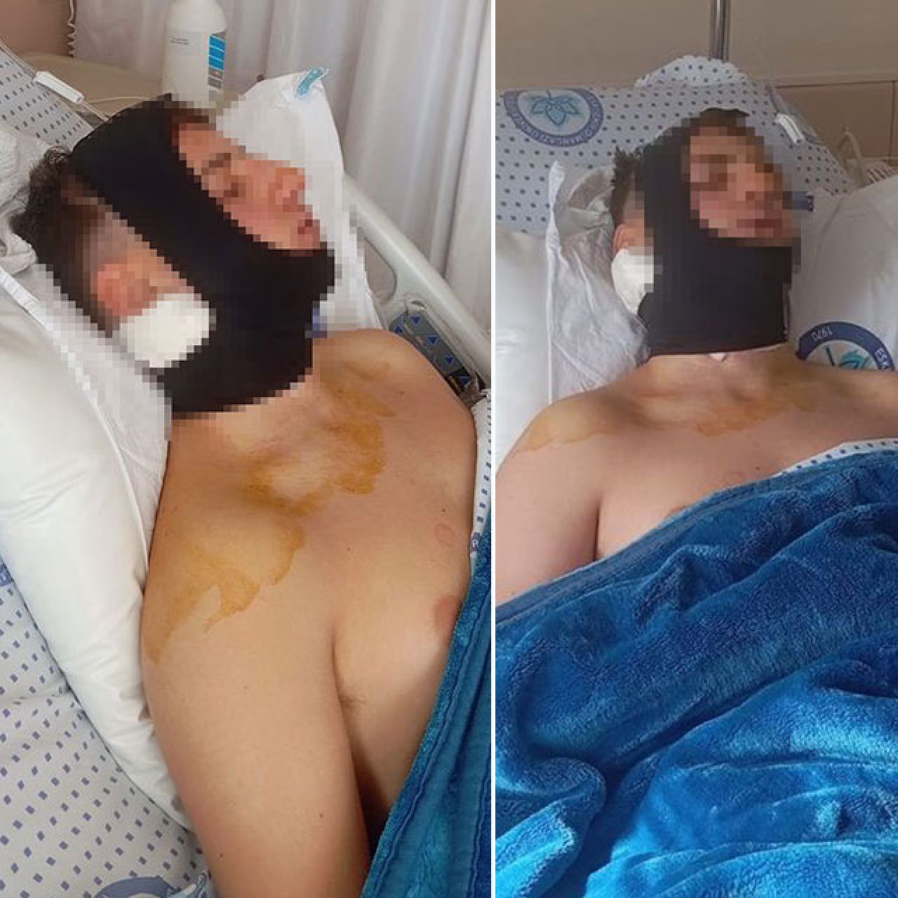 Liseli gencin çenesi ile omuriliğinde kırık var! 4 öğrenci tutuklandı!