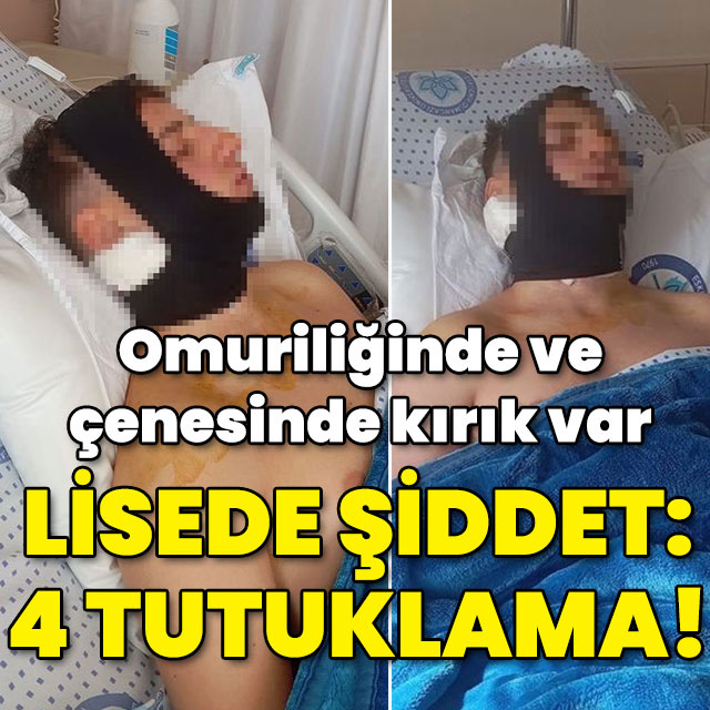 Liseli gencin çenesi ile omuriliğinde kırık var! 4 öğrenci tutuklandı!