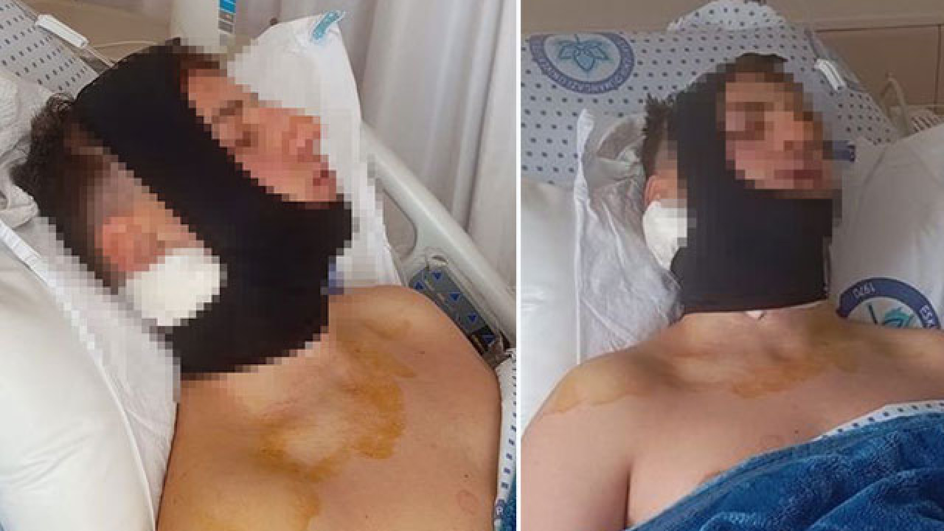 Eskişehir'de Lise Öğrencisine Okul Önünde Saldırı: Çene ve Omurilik Kırığı
