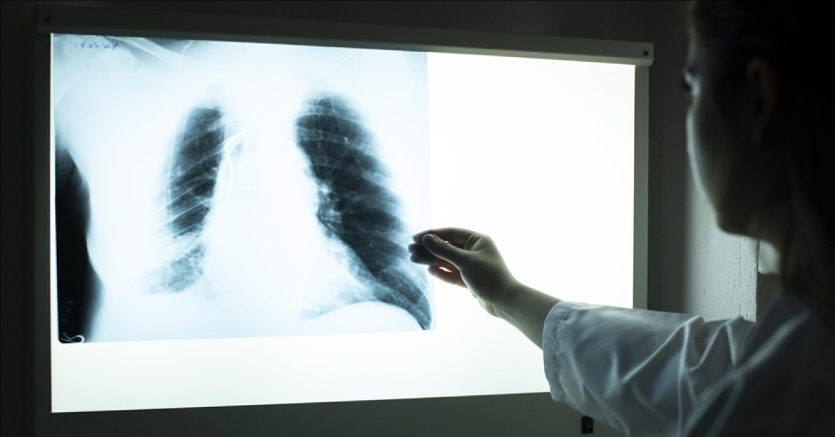 Tütünle mücadelede hedef 1 milyon başvuru