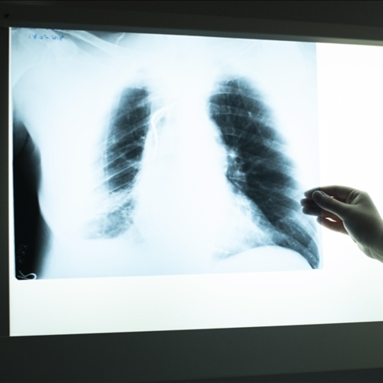 Tütünle mücadelede hedef 1 milyon başvuru