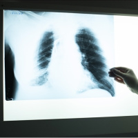 Tütünle mücadelede hedef 1 milyon başvuru