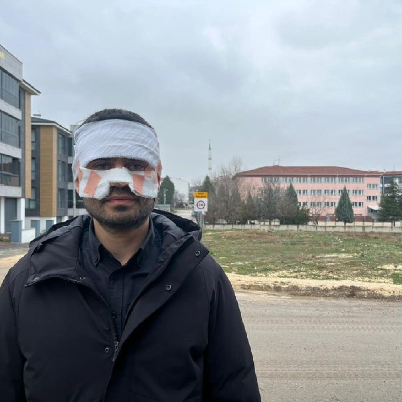 Öğretmen, meslektaşının yüzüne sıcak çay fırlattı!