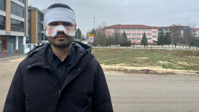 Öğretmen, meslektaşının yüzüne sıcak çay fırlattı!