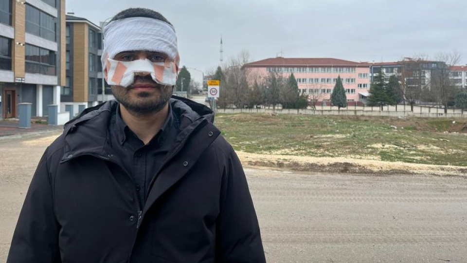 Öğretmen, meslektaşının yüzüne sıcak çay fırlattı!