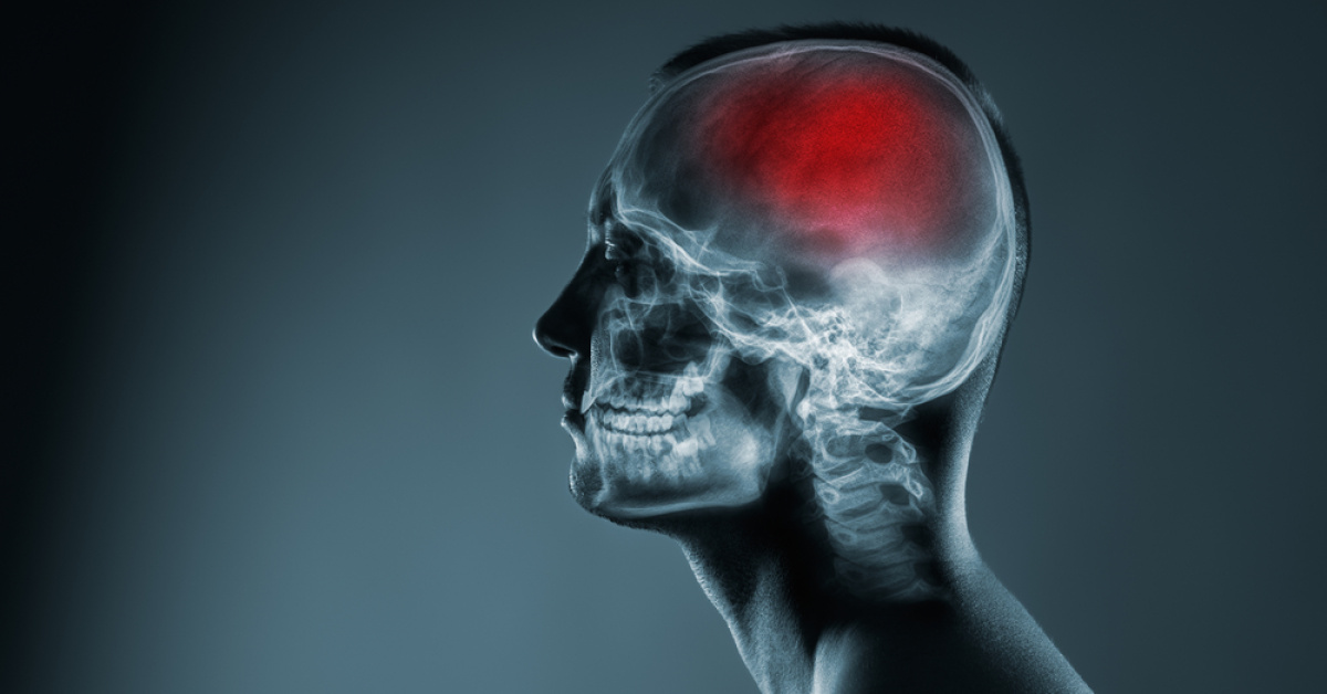 COVID-19 sonrası beyin sisi şikayetleri arttı