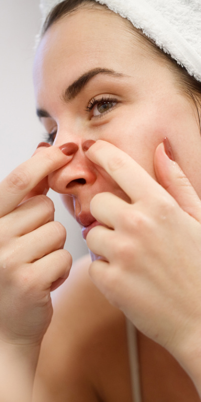 Sivilce patlatmak zararlı mı