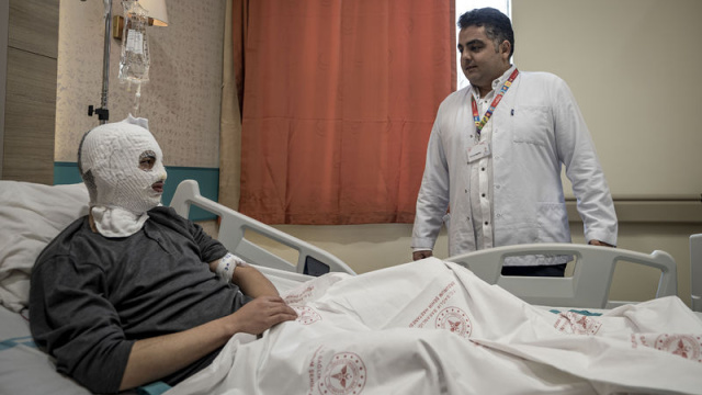 Çakmak gazı faciası! Yüzü ve göğsü yandı!