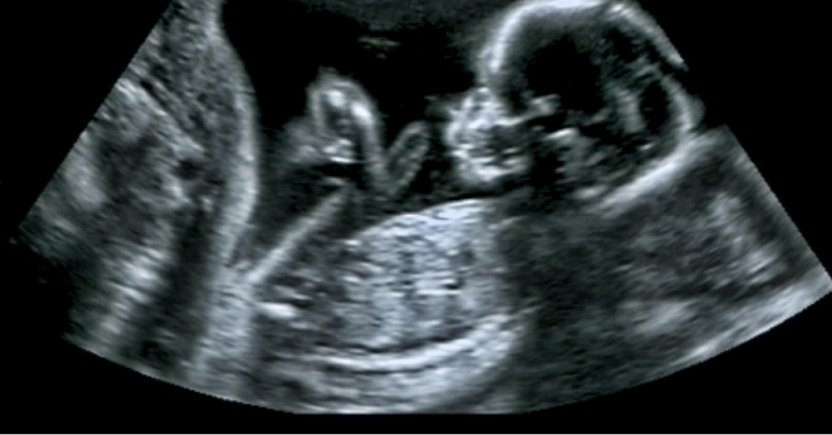 Kalp ve damar sağlığı anne karnında başlıyor