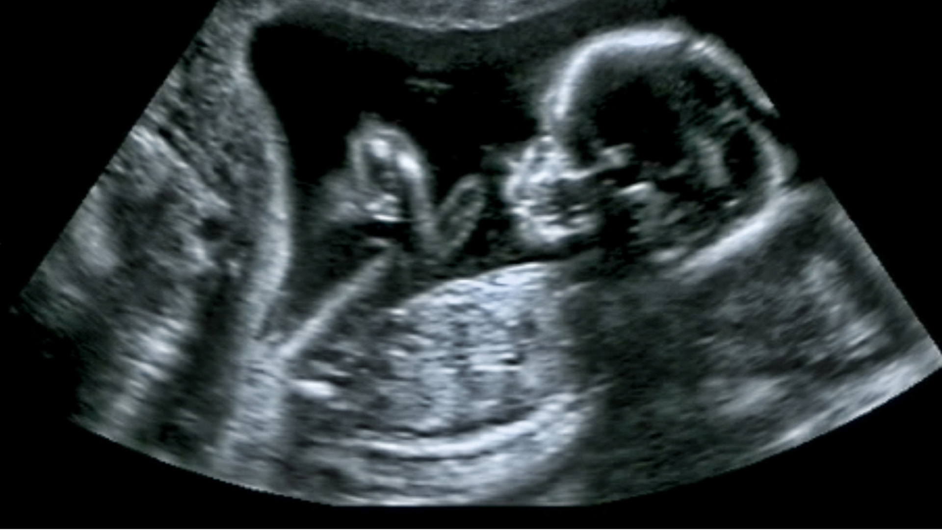 Kalp ve damar sağlığı anne karnında başlıyor | Sağlık Haberleri