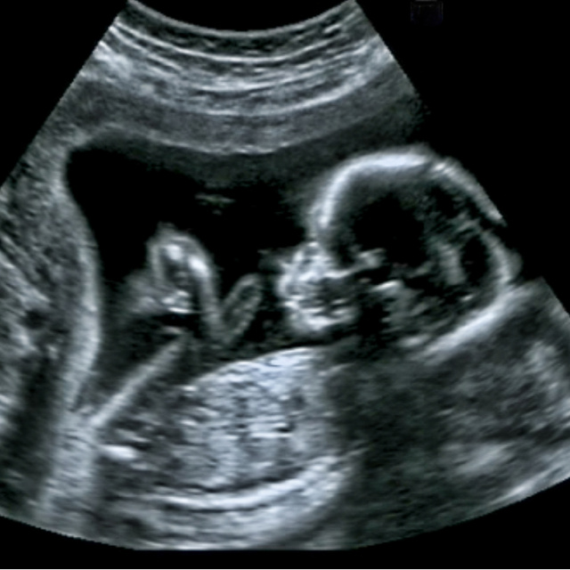 Kalp ve damar sağlığı anne karnında başlıyor