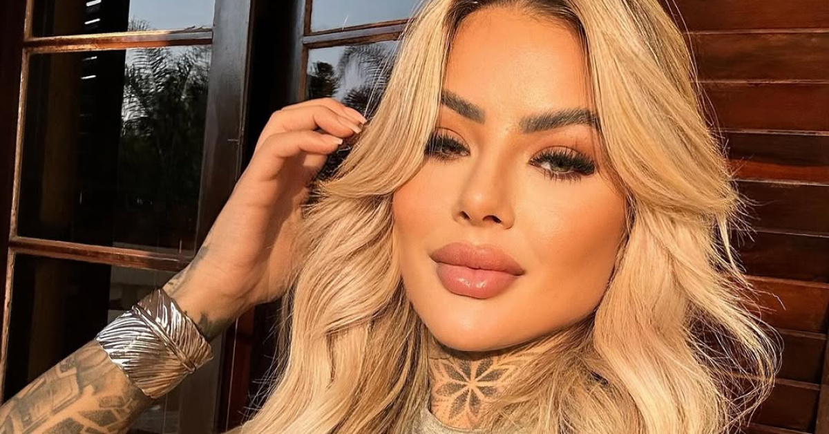 'Yaptırmadım kardeşim' - Hakan Pekere Ait Estetik Operasyonl