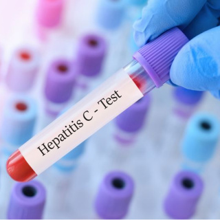 Kapı kapı gezip, Hepatit C virüsü yayıyorlar