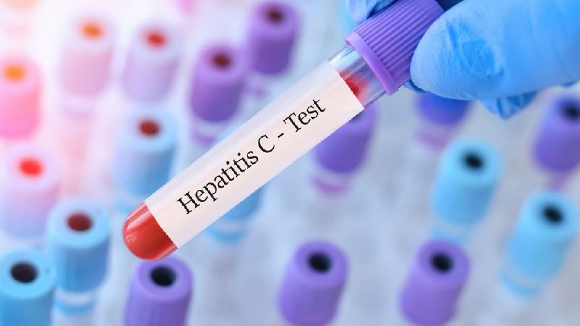 Sahte Sağlıkçılar Kapı Kapı Gezip Hepatit C Virüsünü Yayıyor