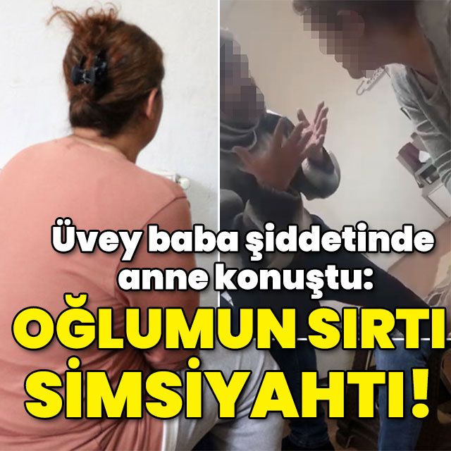 Üvey baba şiddetinde anne konuştu: Oğlumun sırtı simsiyahtı!