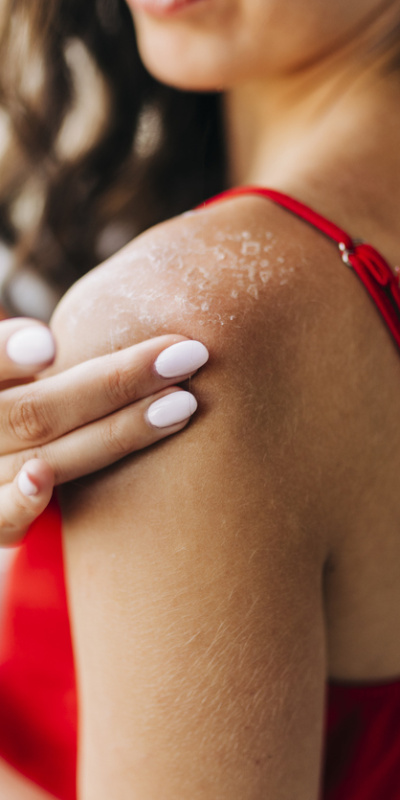 iPhone'daki cilt tipi sorusu ne anlama geliyor?