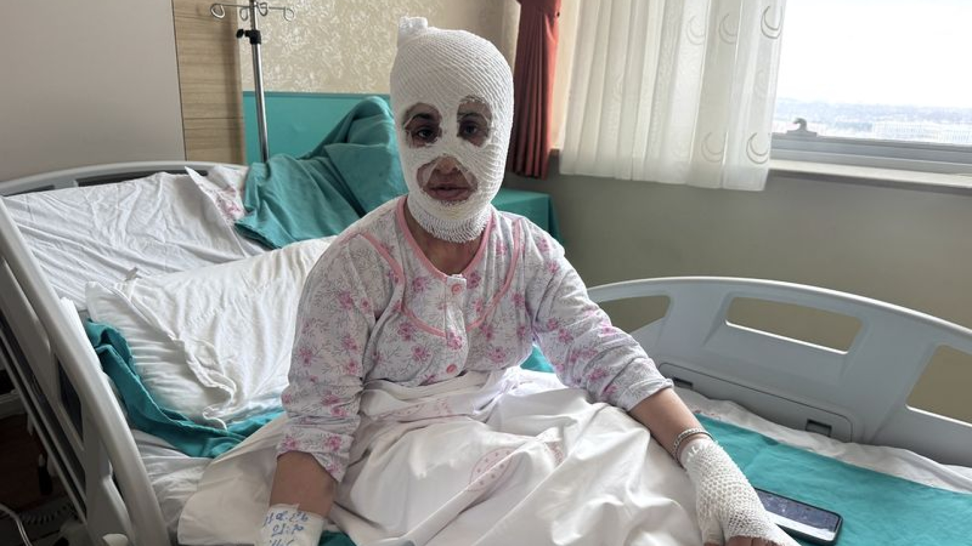 Ağrı'da İftar Hazırlığında Patlayan Düdüklü Tencere İki Çocuk Annesini Yanık Merkezine Ulaştırdı