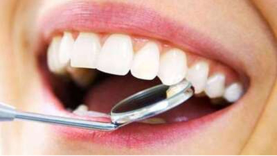 Evde Diş Taşı Temizliği Nasıl Yapılır?
