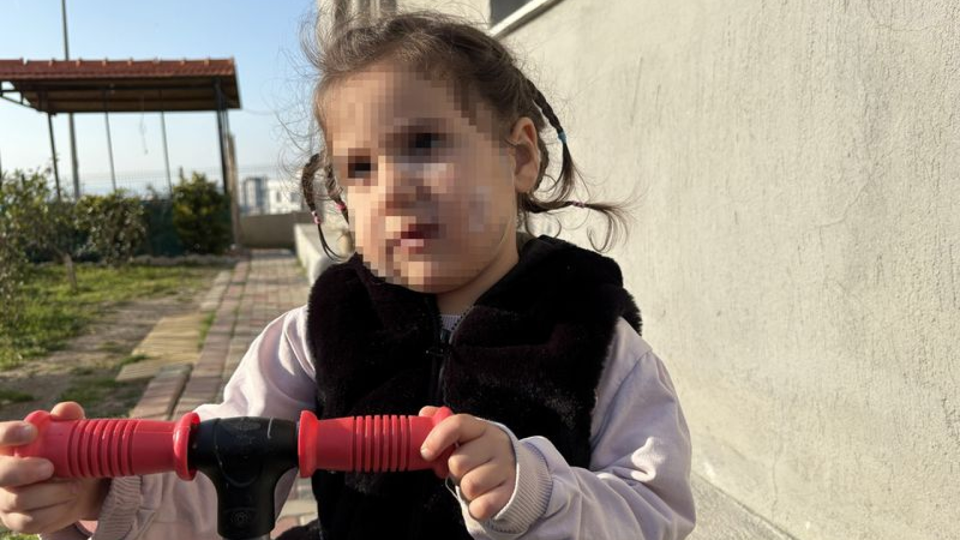 İzmir'de Köpek Dehşeti: 3 Yaşındaki Ada'nın Yüzü Pençe ve Isırıkla Dolu