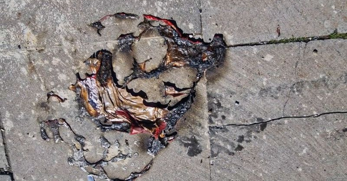 Helyum Balonları Yüzlerinden Yanıklar