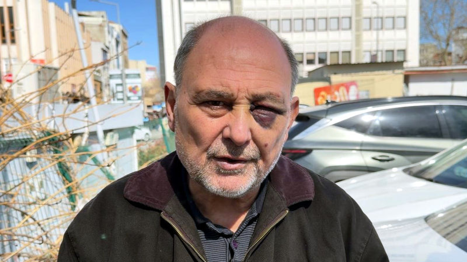 Son dakika: Annesinin cenazesinden dönüşte darbedildi: Çift görüyorum, iyi değilim, şikayetçiyim