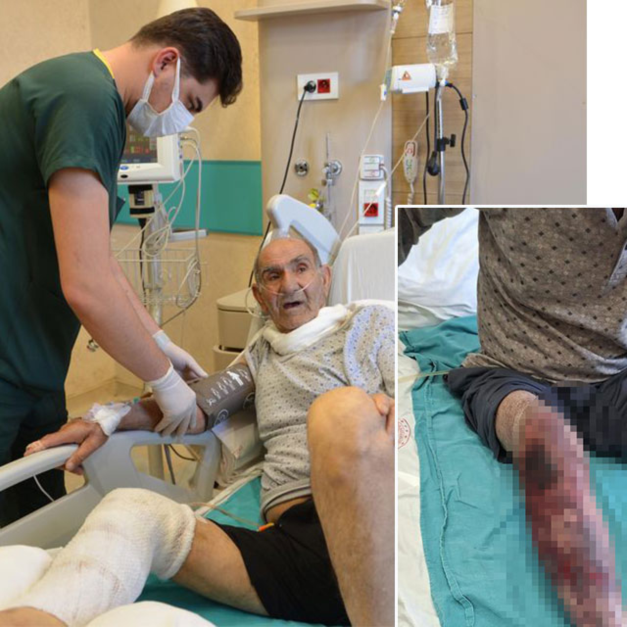 Herkesin başına gelebilir... Tıkalı lavaboyu açacaktı! Kimyasal yanık!