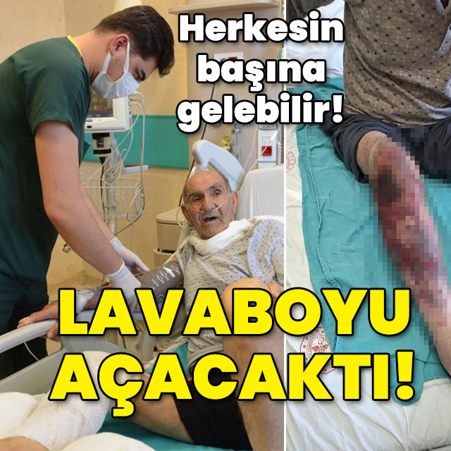 Herkesin başına gelebilir... Tıkalı lavaboyu açacaktı! Kimyasal yanık!