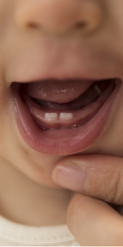 Bebeğin ilk dişlerinin kritik önemi ne?