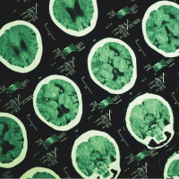 Türk Nöroloji Derneği: Beynin sağlığı gece başlar