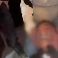 Ağzını ve ellerini bantladılar, darp görüntülerini paylaştılar