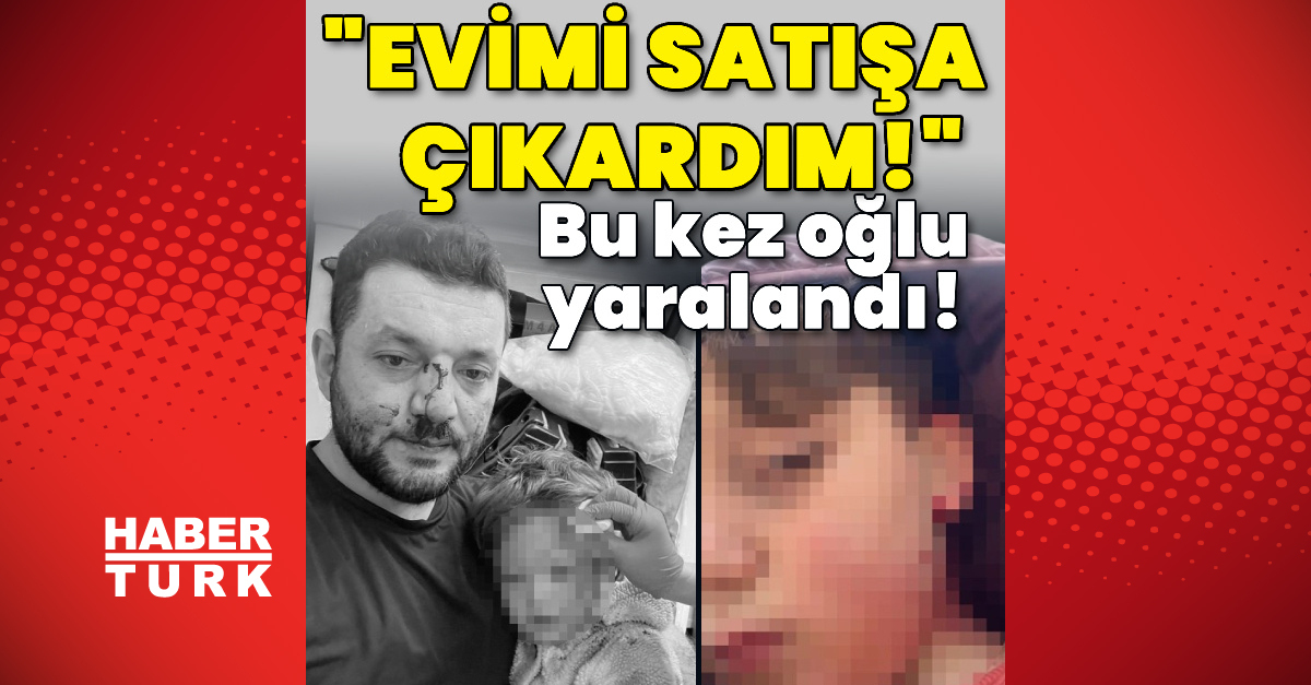 Yaralanan Baba ve Oğlu! Evden Tehditler Alıyorlar