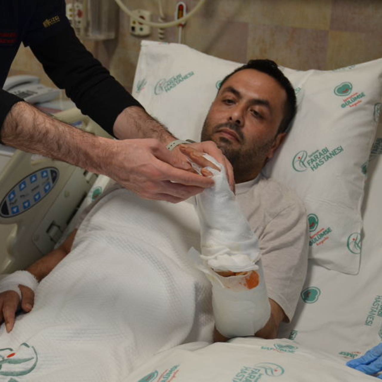 Elektrik akımına kapıldı! Bacağından alınan deri eline nakledildi