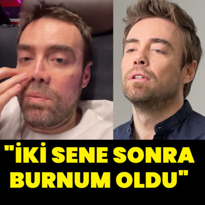 "İki sene sonra burnum oldu"