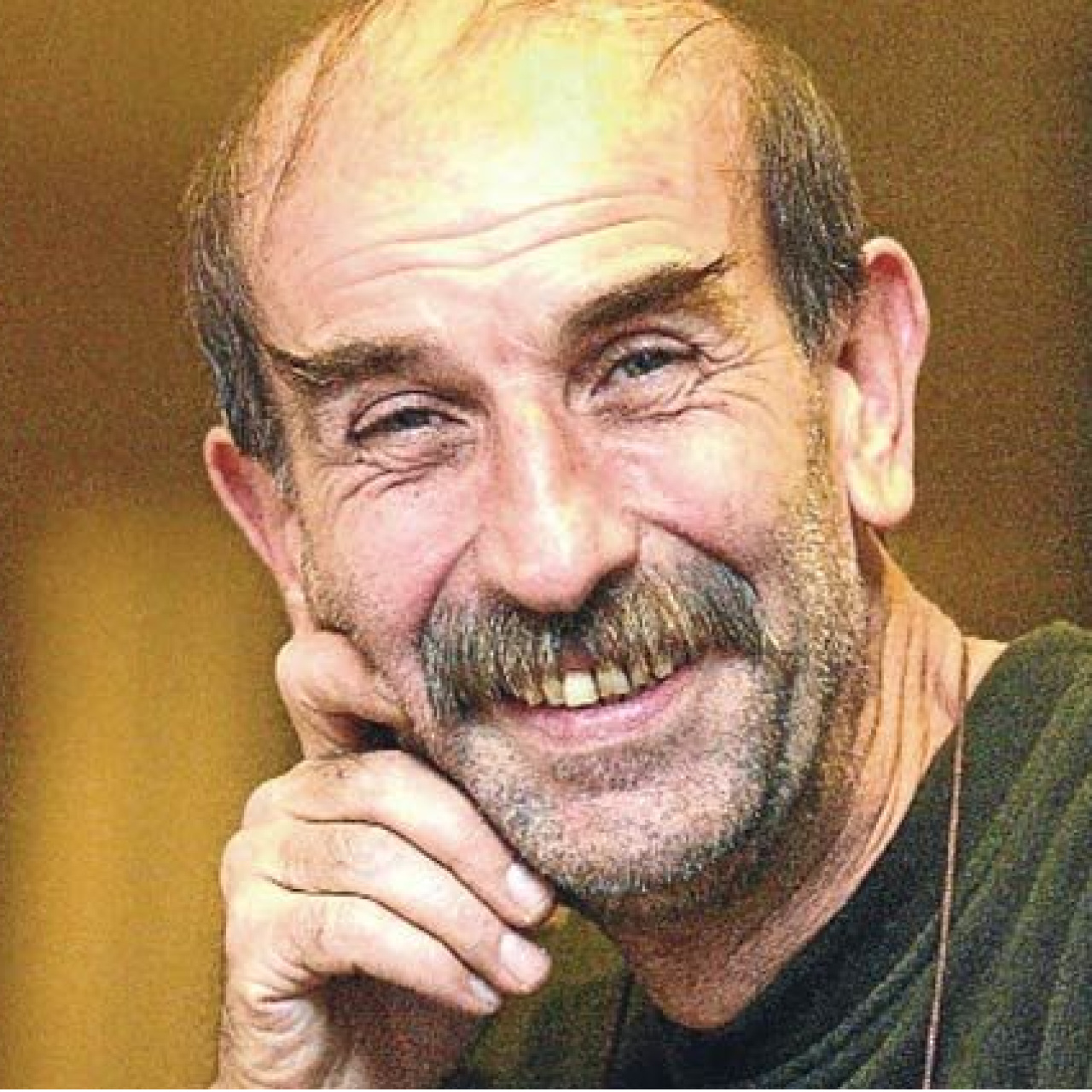 Sinan Bengier ameliyat oldu