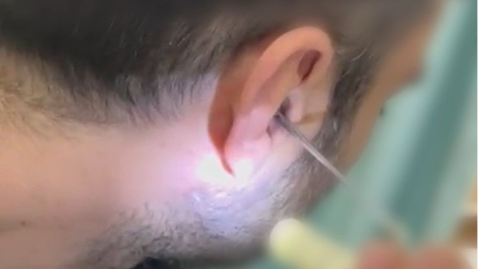 Kulağının içinden uyuşturucu çıktı!