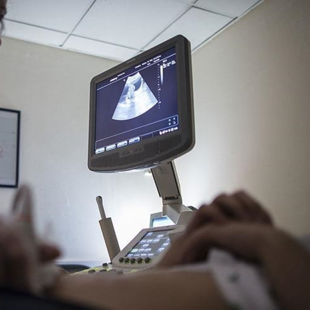 Her 10 kadından birinde çikolata kisti görülüyor