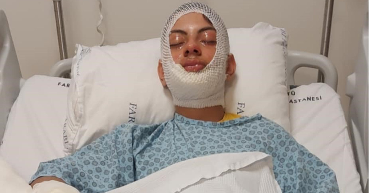 Trabzon'dabenzin döktüğü ateşe yaran Demir