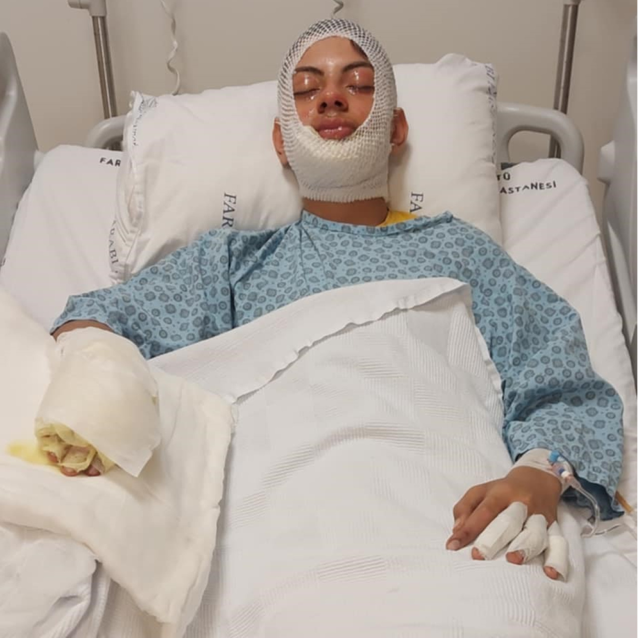 Ateşe benzin döktü, ölümden döndü!