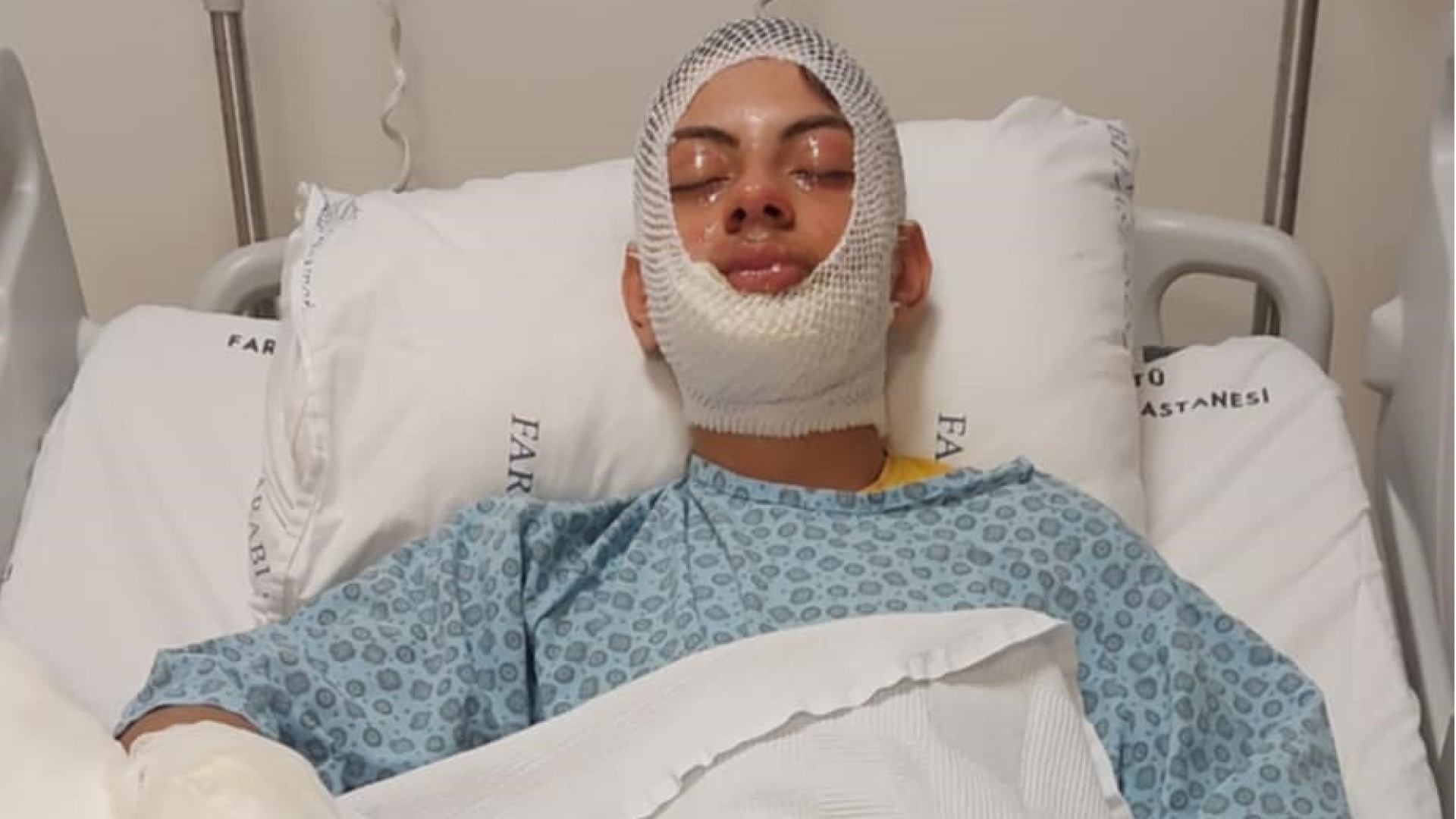 Ateşe benzin döktü, ölümden döndü! | Son dakika haberleri