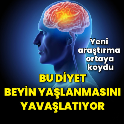 Yeni araştırma: Bu diyet beyin yaşlanmasını yavaşlatıyor