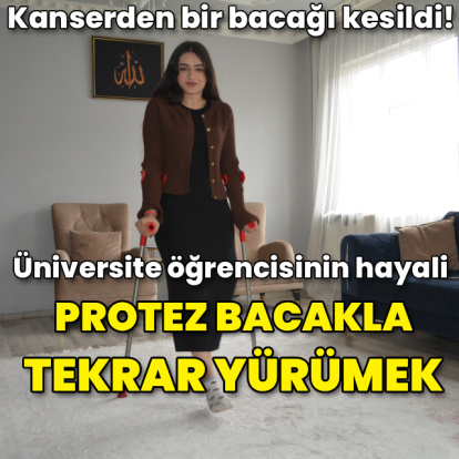 Kanserden bir bacağı kesildi! Hayali protez bacakla tekrar yürümek