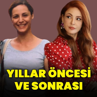 Yıllar öncesi ve sonrası