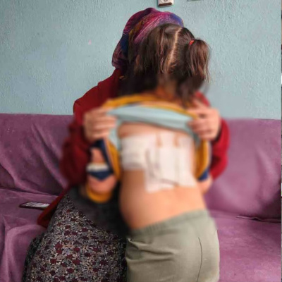 Minik çocuğa eşek saldırısı