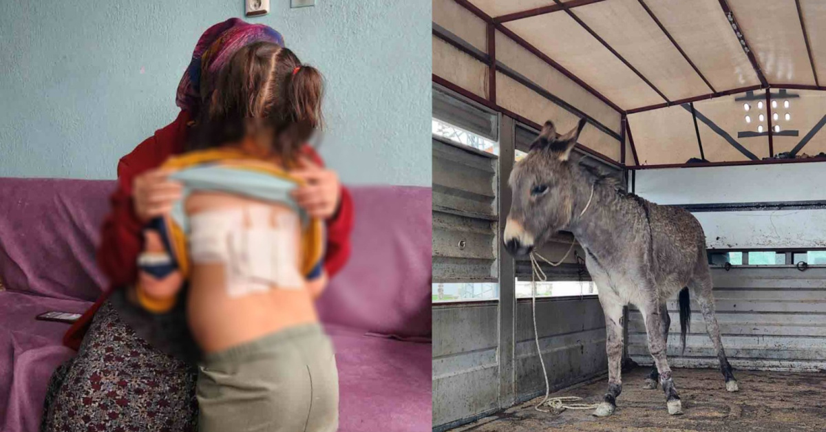 Eşeğin saldırısı! Çocuk yaralandı vekamerada olay