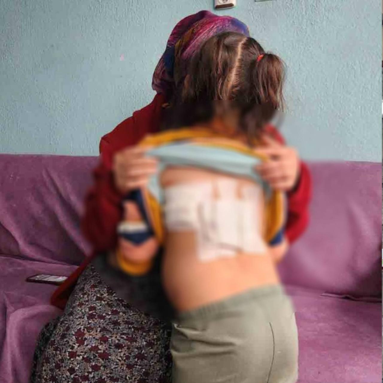 Minik çocuğa eşek saldırısı 