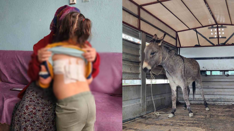 Minik çocuğa eşek saldırısı