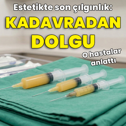 Estetiğin son çılgınlığı: Kadavradan dolgu