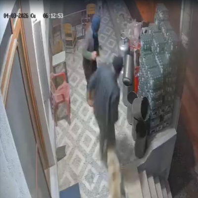 Köpek saldırısında parmağı koptu!