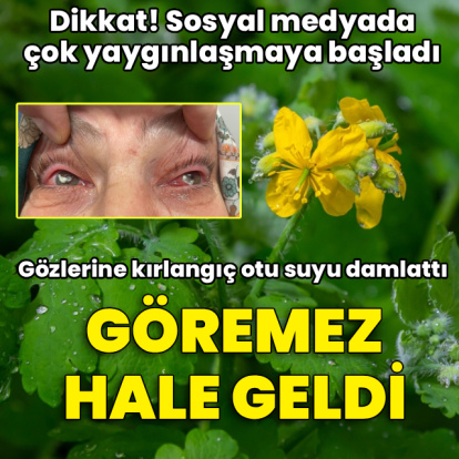 Gözlerine kırlangıç otu suyu damlattı, göremez hale geldi